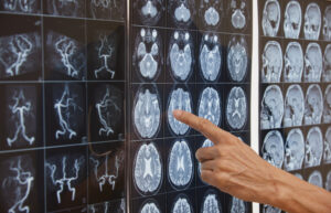 View of MRI Scans