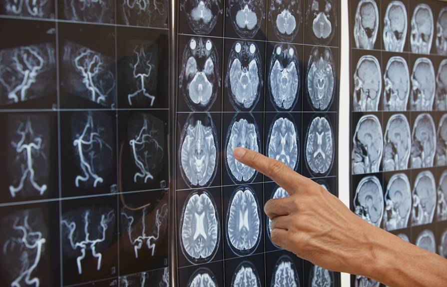 View of MRI Scans