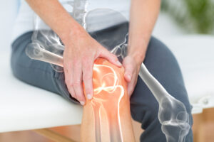 Concept of Orthopedic Imaging of patients knee