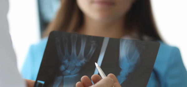 Close-up-Of-Doctor-Hands-Holding-XRay