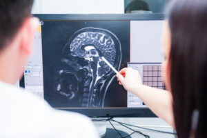Doctors reviewing MRI of brain