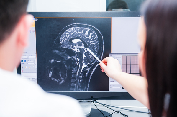 Doctors reviewing MRI of brain