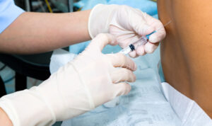 Close up of Epidural Injection
