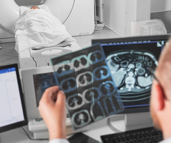 Radiologist reviewing scans of lungs