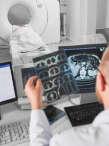 Radiologist reviewing scans of lungs