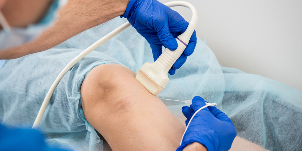 close up of Radiofrequency Ablation